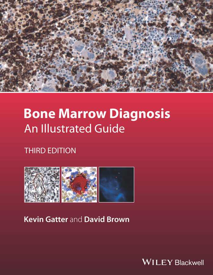 Bone Marrow Diagnosis: An Illustrated Guide book cover by Kevin Gatter, David Brown