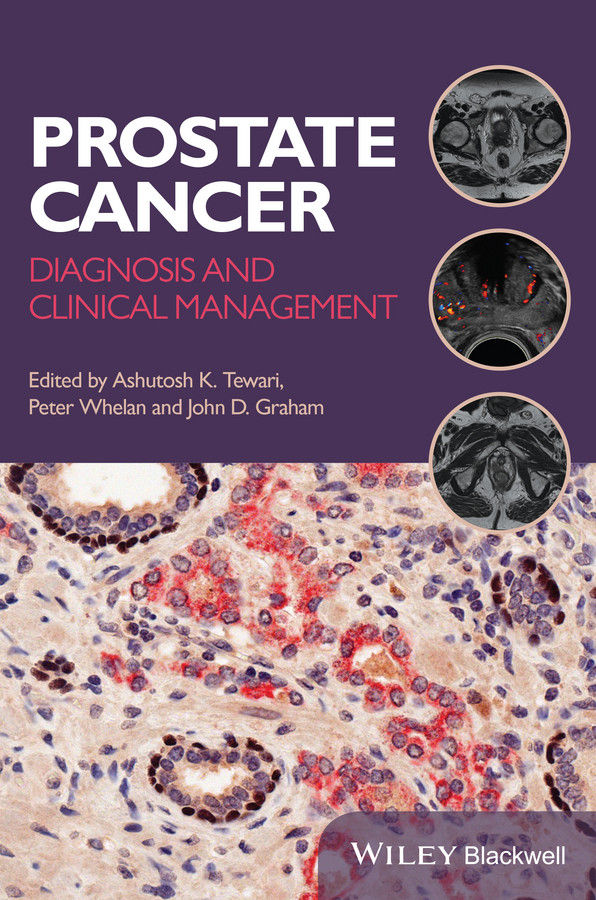 Prostate Cancer: Diagnosis and Clinical Management book cover by 