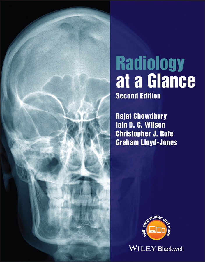 Radiology at a Glance (At a Glance) book cover by Rajat Chowdhury, Iain Wilson, Christopher Rofe, Graham Lloyd-Jones