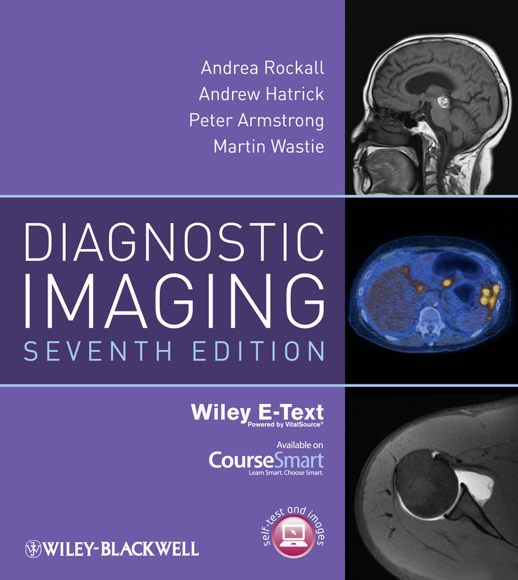 Diagnostic Imaging, Includes Wiley E-Text book cover by Andrea G. Rockall, Andrew Hatrick, Peter Armstrong, Martin Wastie