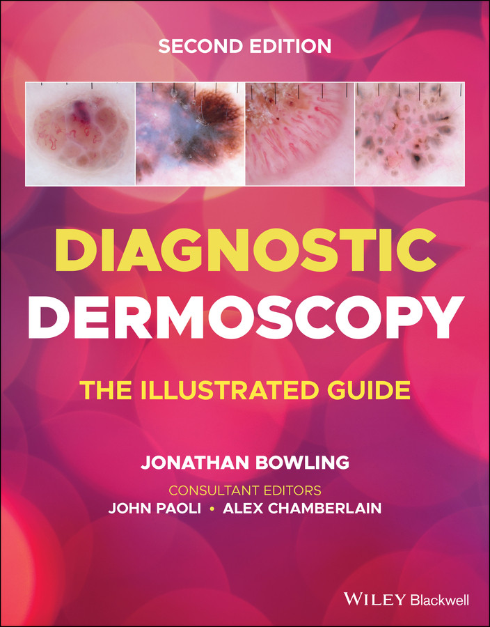 Diagnostic Dermoscopy: The Illustrated Guide book cover by 
