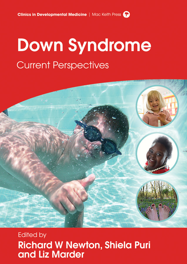 Down Syndrome: Current Perspectives (Clinics in Developmental Medicine) book cover by Richard W. Newton, Liz Marder, Shiela C. Puri