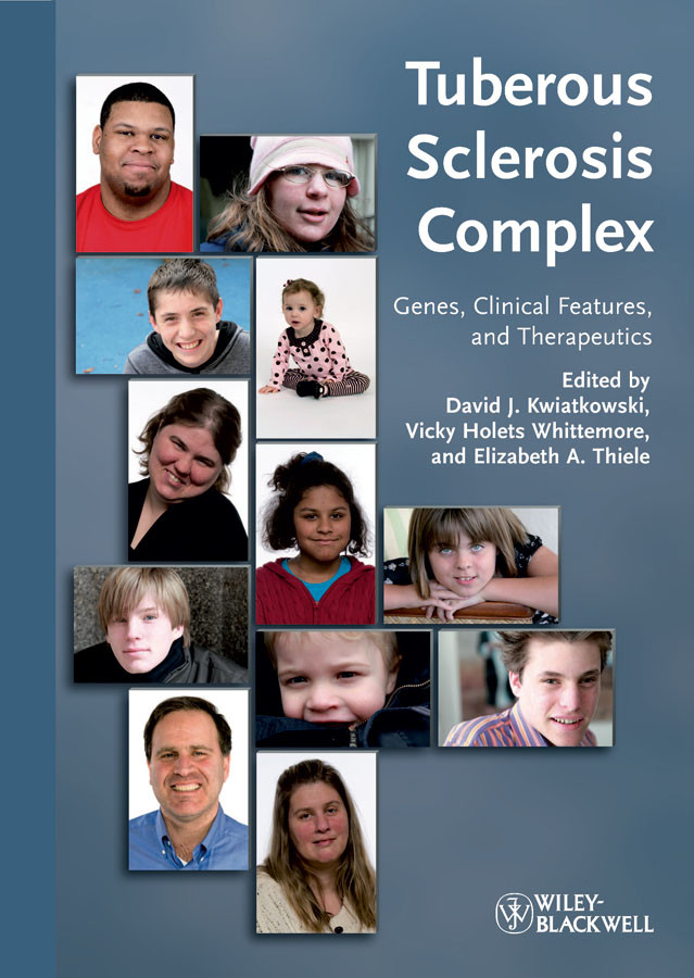 Tuberous Sclerosis Complex: Genes, Clinical Features and Therapeutics book cover by 