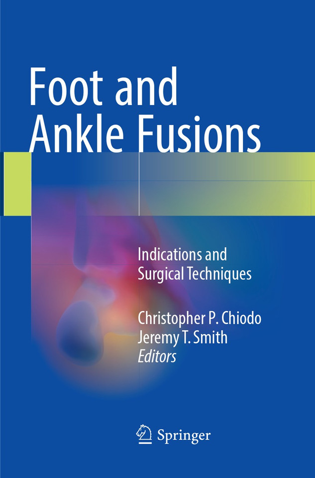 Foot and Ankle Fusions: Indications and Surgical Techniques book cover by 
