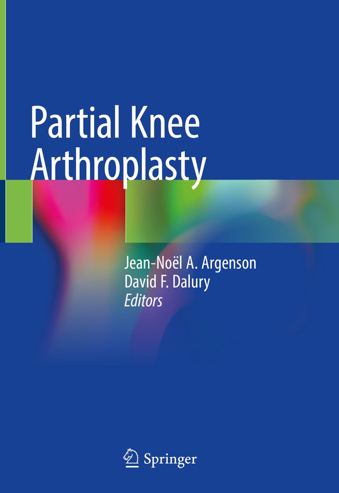 Partial Knee Arthroplasty book cover by 