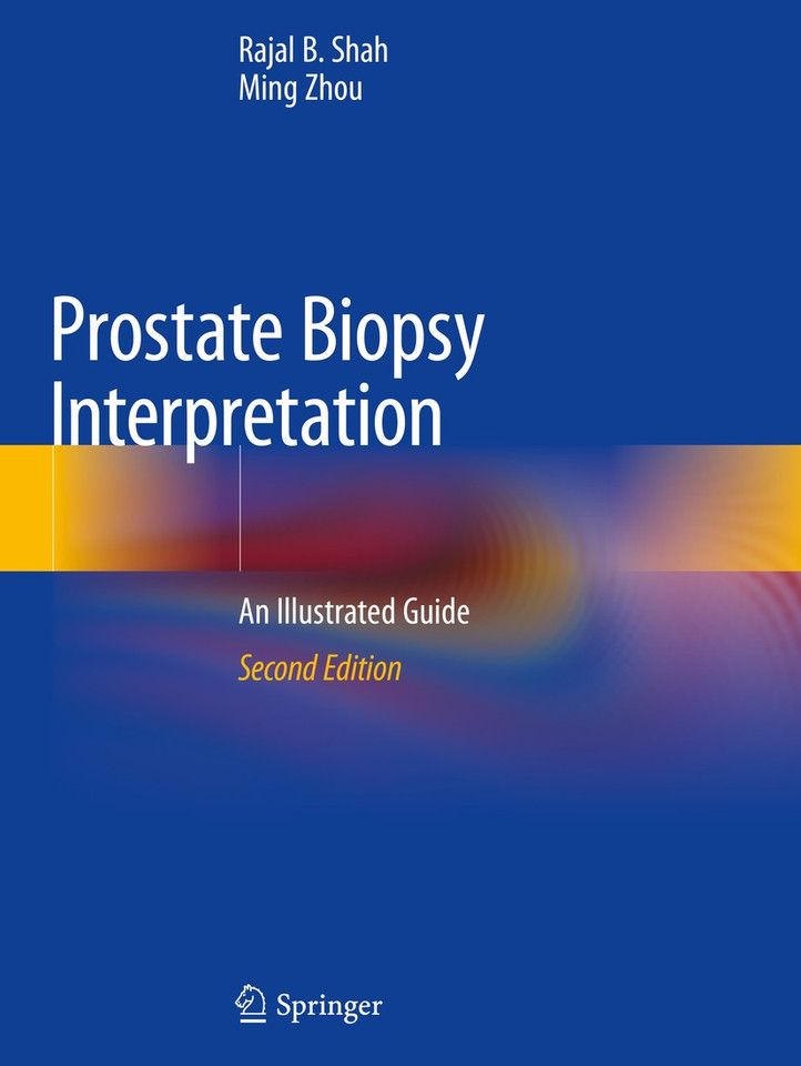 Prostate Biopsy Interpretation: An Illustrated Guide book cover by Rajal B. Shah, Ming Zhou