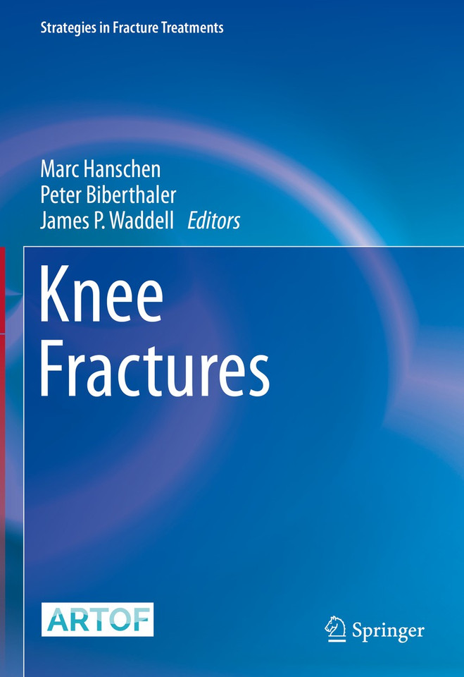 Knee Fractures (Strategies in Fracture Treatments) book cover by 