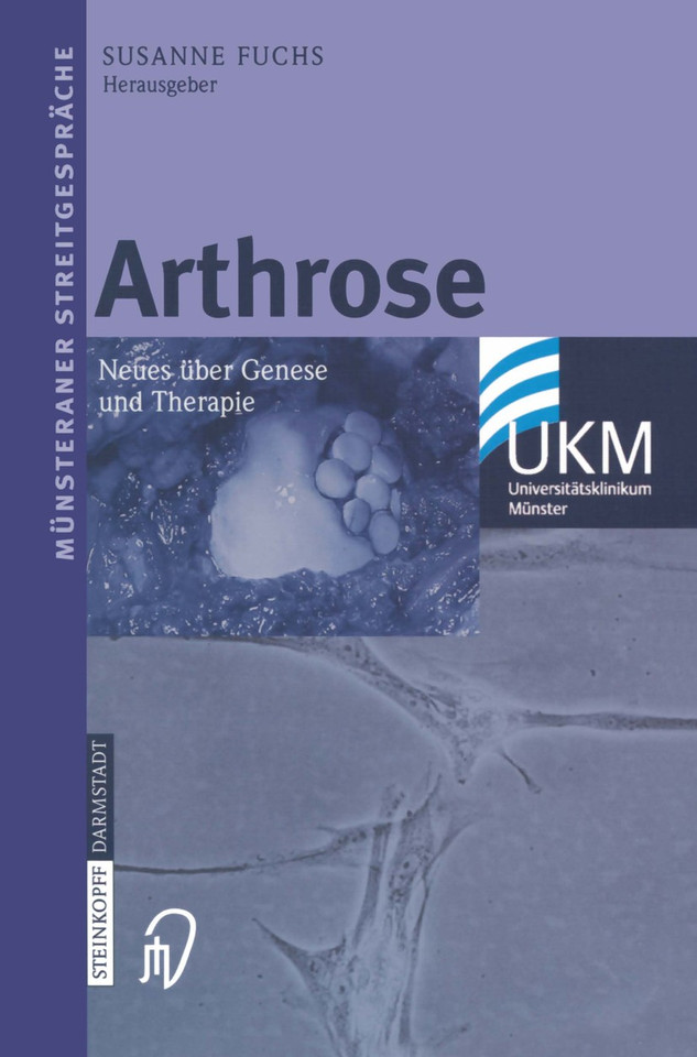 Arthrose: Neues über Genese und Therapie (Münsteraner Streitgespräche) book cover by 