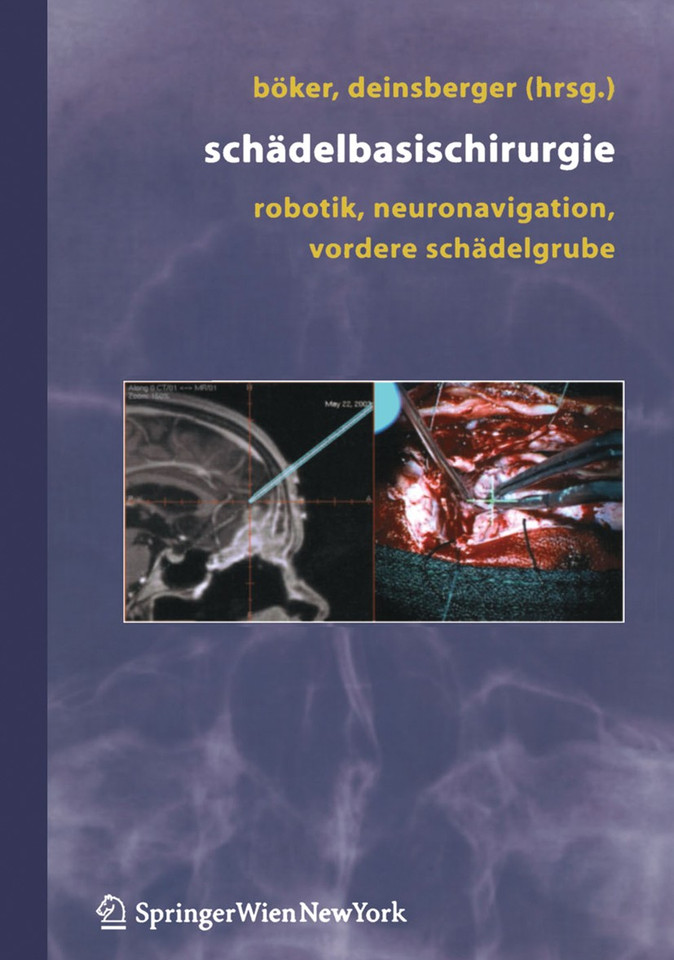 Schädelbasischirurgie: Robotik, Neuronavigation, vordere Schädelgrube book cover by 