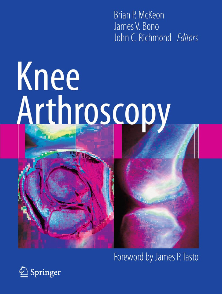 Knee Arthroscopy book cover by 