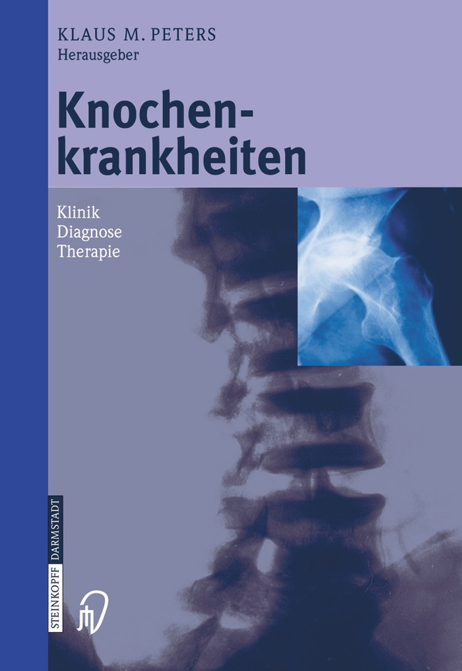 Knochenkrankheiten: Klinik Diagnose Therapie book cover by 