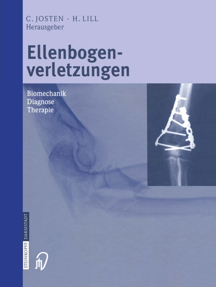 Ellenbogenverletzungen: Biomechanik ■ Diagnose ■ Therapie book cover by 