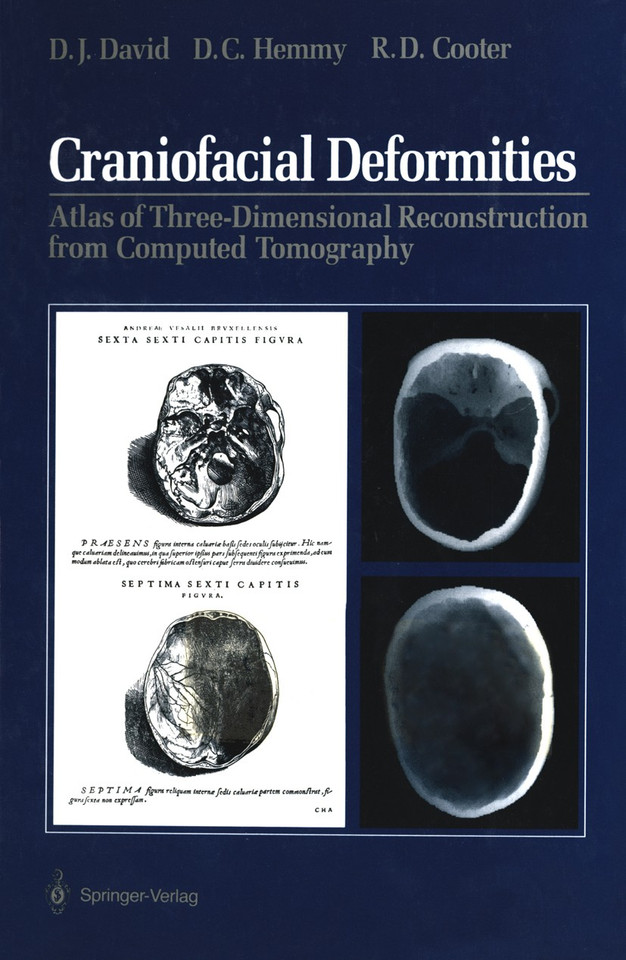 Craniofacial Deformities: Atlas of Three-Dimensional Reconstruction from Computed Tomography book cover by David J. David, David C. Hemmy, Rodney D. Cooter
