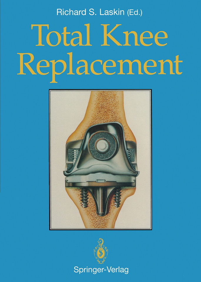 Total Knee Replacement book cover by 