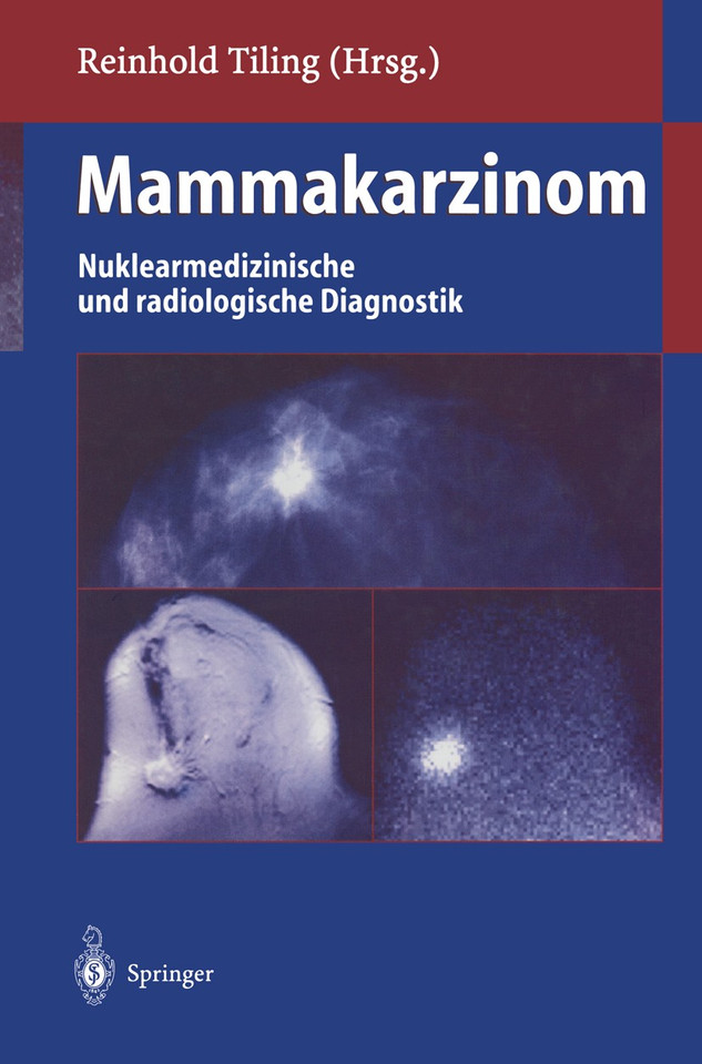 Mammakarzinom: Nuklearmedizinische und radiologische Diagnostik book cover by 