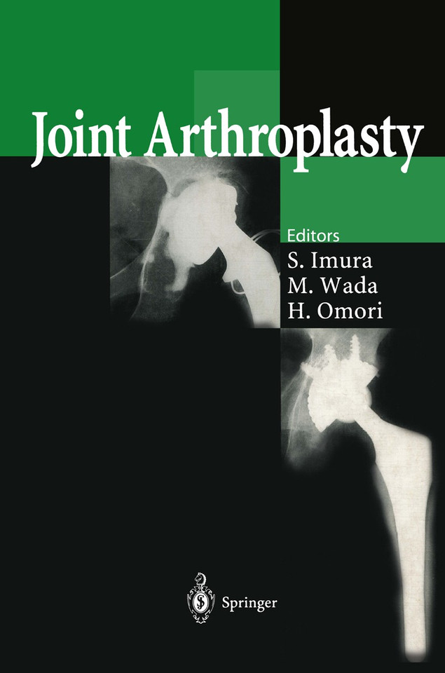 Joint Arthroplasty book cover by 