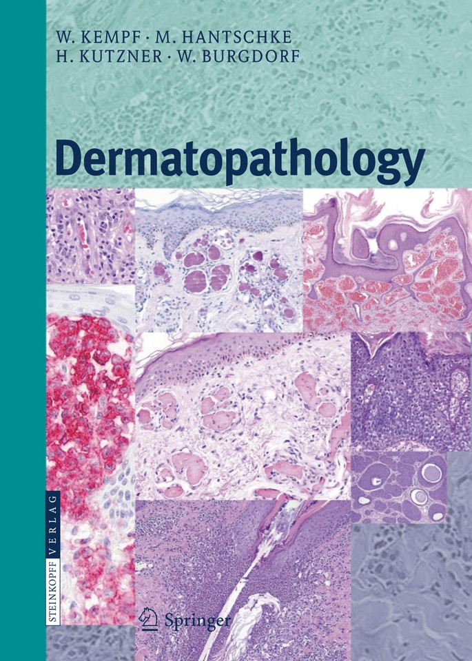 Dermatopathology book cover by Werner Kempf, Markus Hantschke, Heinz Kutzner, Walter H.C. Burgdorf