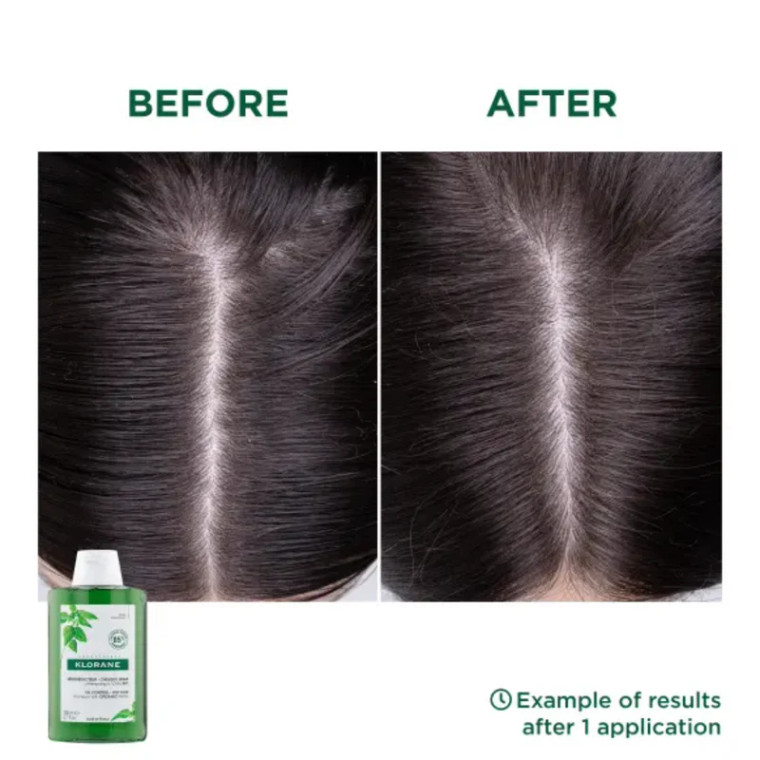 Klorane Oil‑Control Shampoo with Organic Nettle