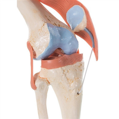 3B Scientific Functional Human Knee Joint Model with Ligaments & Marked Cartilage Smart Anatomy