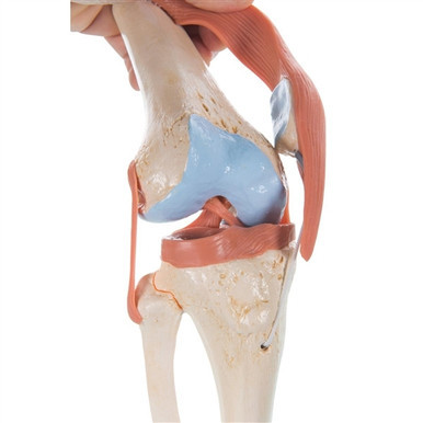 3B Scientific Functional Human Knee Joint Model with Ligaments & Marked Cartilage Smart Anatomy