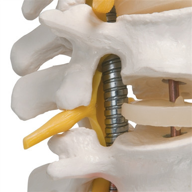 3B Scientific Highly Flexible Human Spine Model, Mounted on a Flexible Core Smart Anatomy