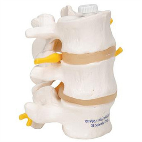 3B Scientific 3 Human Lumbar Vertebrae, Flexibly Mounted Smart Anatomy