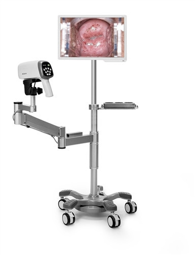 Edan C6A Video Colposcope w/ HD Camera (40 LED Lights)