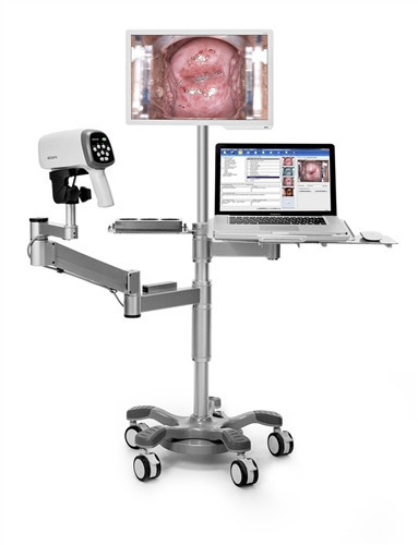 Edan C6A Video Colposcope w/ HD Camera (40 LED Lights)
