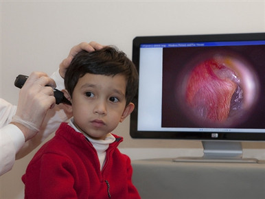 Firefly Wireless Digital Video Otoscope