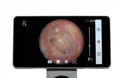 RCS-100 Camera Set. Includes RCS-100 camera, imaging, dermatoscope, and otoscope lenses