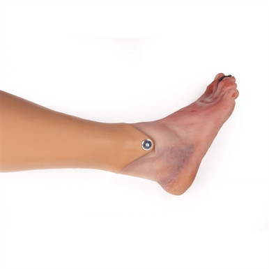 Erler Zimmer Wound Foot with Diabetic Foot Syndrome, Manikin Version