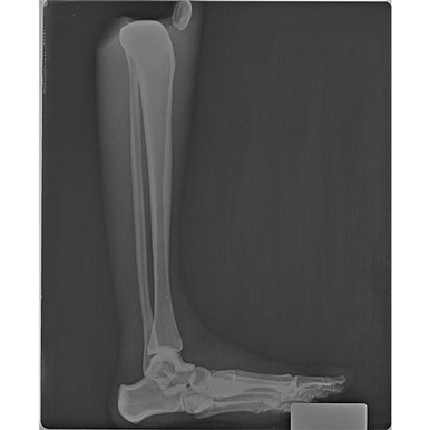 RSD Damaged Debbie; Teaching / Training System