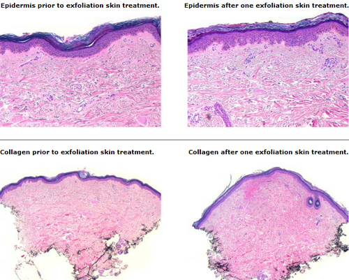 Multiderm