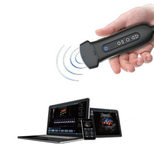 portable ultrasound machine