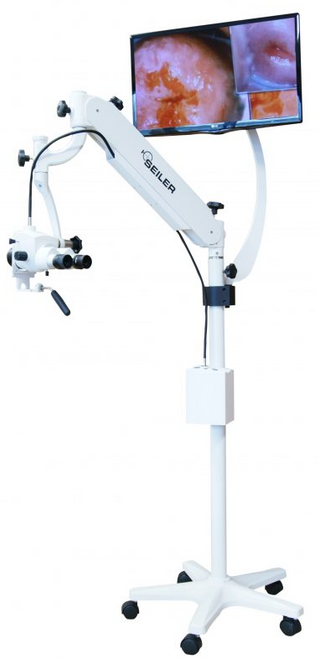Buy Colposcope