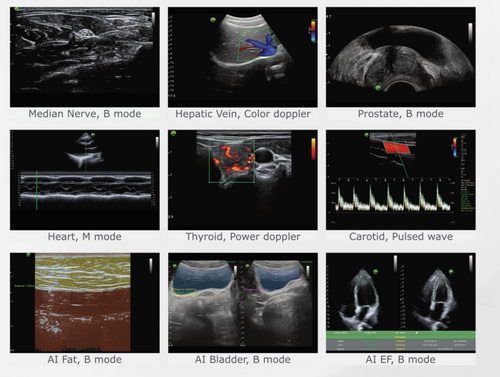 Infinium VioScan C7 Convex Handheld Ultrasound
