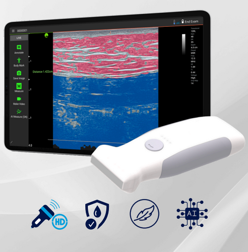 Infinium VioScan L2 Linear Handheld Ultrasound