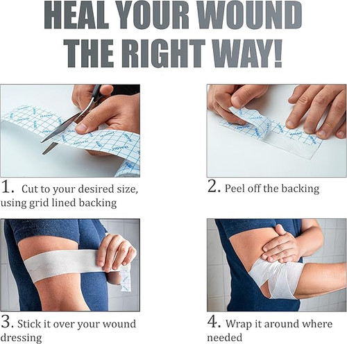 HealQu 90227611 HEALQU Non-woven Retention Tape 6 in. x 11 yd. (1 Roll)