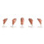 Erler Zimmer Head for Facial Injections, Version C