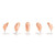 Erler Zimmer Head for Facial Injections, Version G