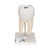 3B Scientific Lower Twin - Root Molar with Cavities Human Tooth Model