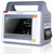 remote patient monitoring system