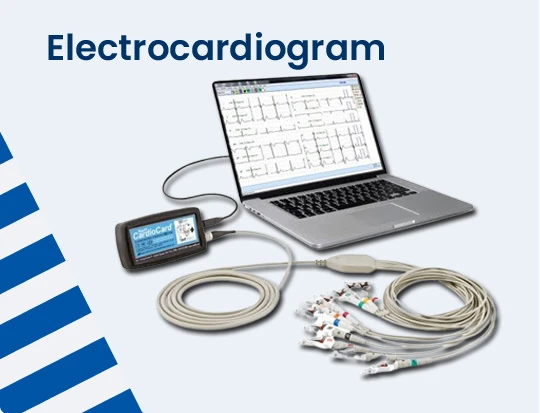 ECG