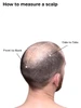 How to measure a scalp