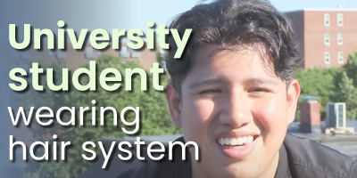 Testimonial: How a hair system helped a university student become more confident