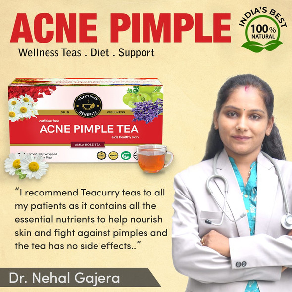Acne Tea (1 Month Pack | 30 Tea Bags) - Helps in Pimples, Cysts, Pustules & Nodules  |  By Teacurry   |  3.53 oz   |  0.22 lbs