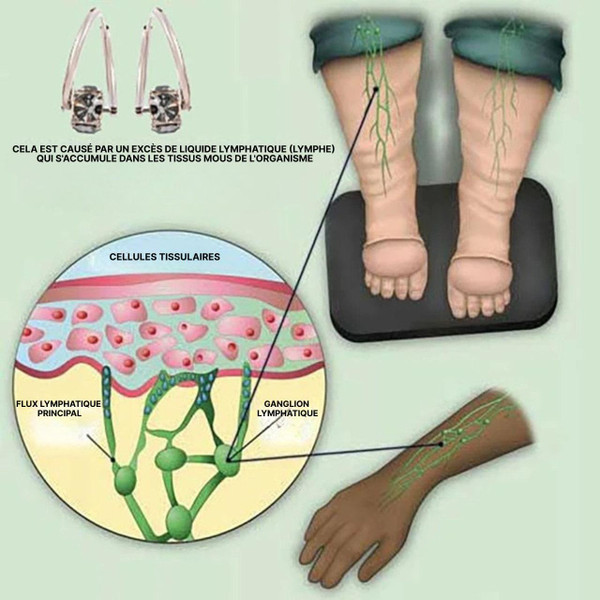 Boucles d'Oreilles Magnétiques Pour Maigrir zaxx