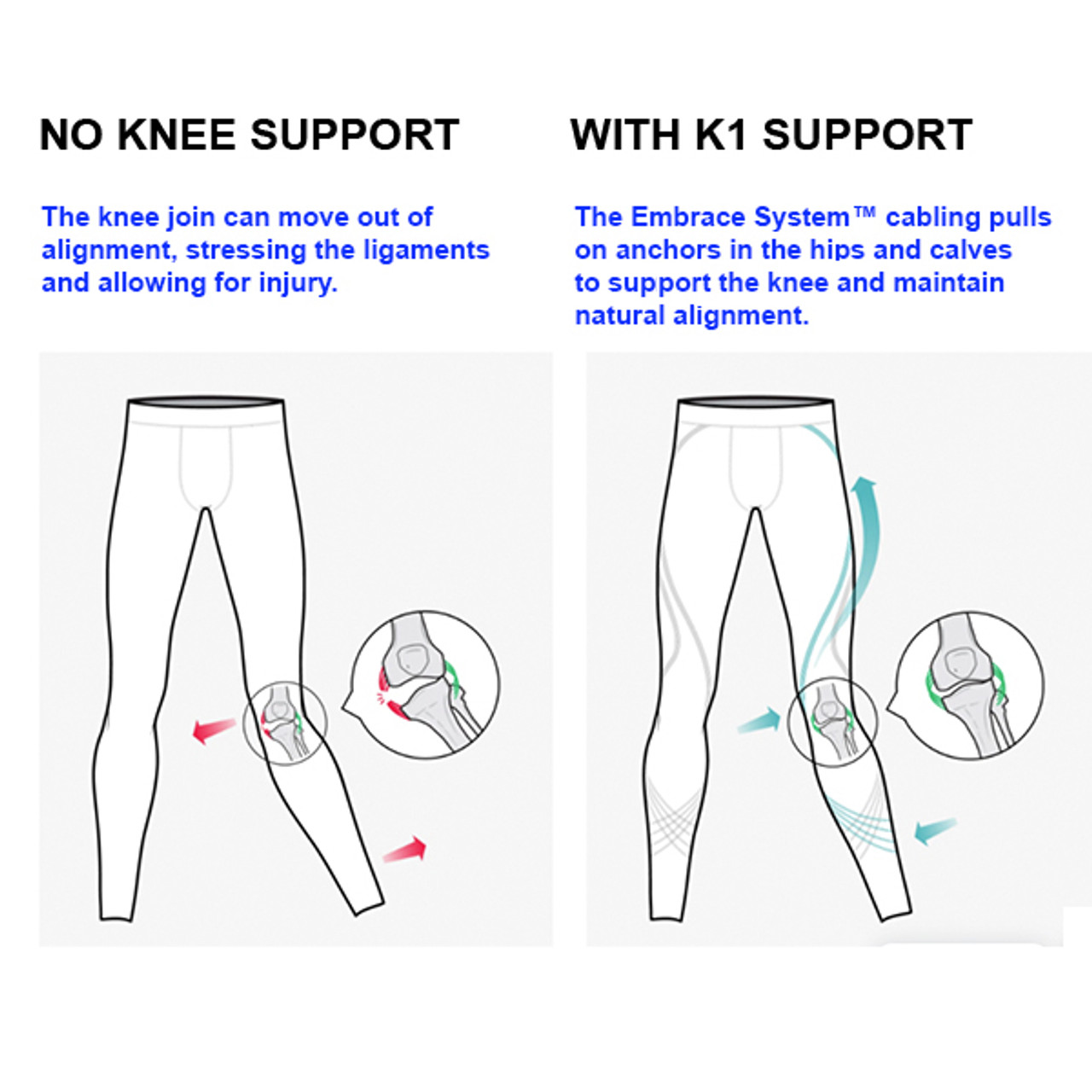 Best Knee Brace - Stoko K1 Flux - Supportive Tight