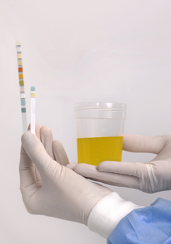 Análisis rápido de orina en Farmacia Gran Vía, en Valencia