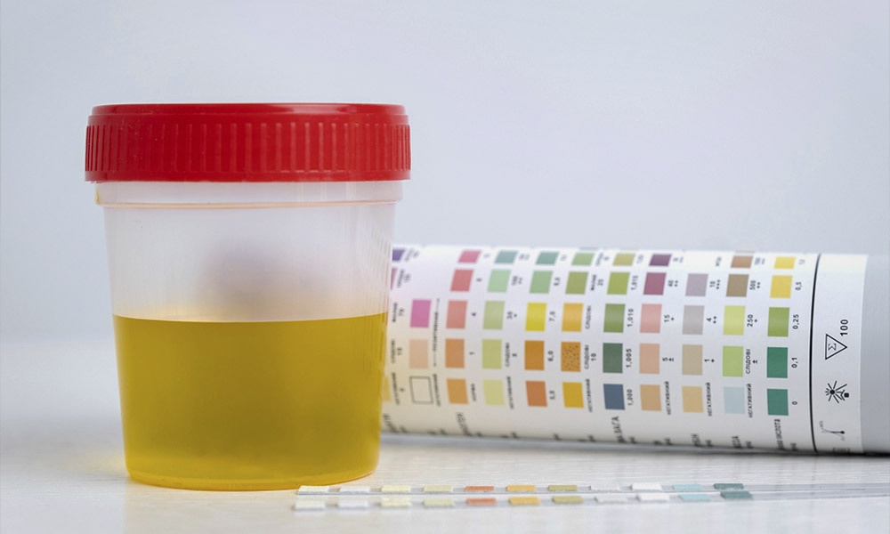 Análisis rápido de orina en Farmacia Gran Vía, en Valencia